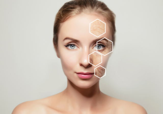 Keep Your Complexion Healthy