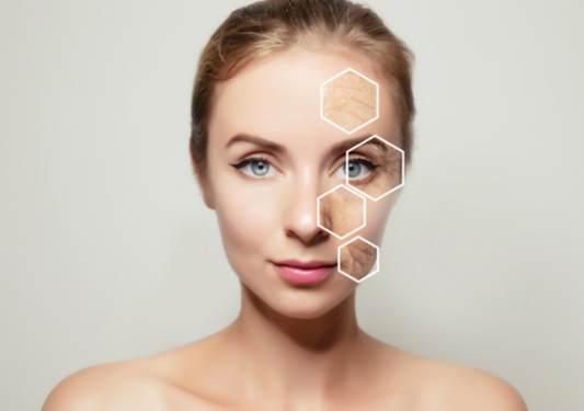 Keep Your Complexion Healthy